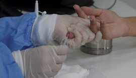 Anvisa aprova aplicação de testes rápidos para Covid-19 em farmácias