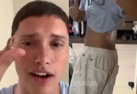 Jovem acorda com bala perdida nas costas e história viraliza; veja o vídeo