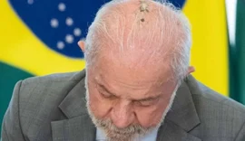 Lula passa por novas sessões de radioterapia no couro cabeludo