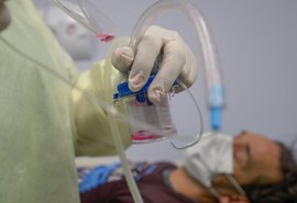 Sesau confirma teste positivo para covid-19 em óbito desta segunda (31)