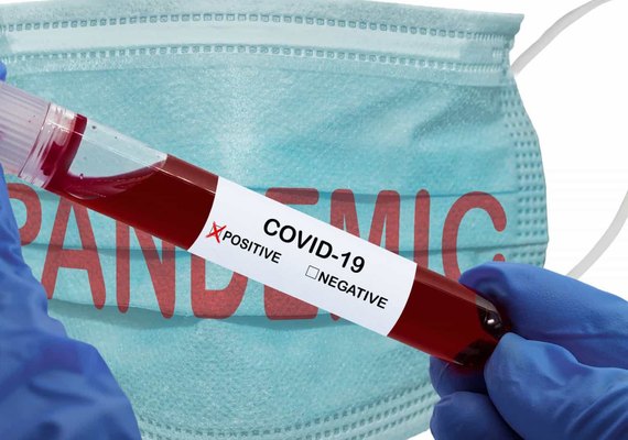 Erupções nos pés pode ser novo sintoma de coronavírus