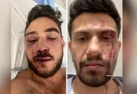 Vídeo mostra momento da agressão a alagoano em bar de Portugal; confira