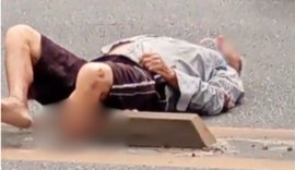 Homem sofre fratura exposta após acidente na Av. Menino Marcelo, em Maceió