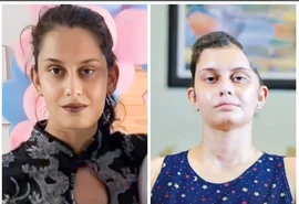 Jovem atingida por rampa em festival de rap passa por cirurgia de reconstrução craniana