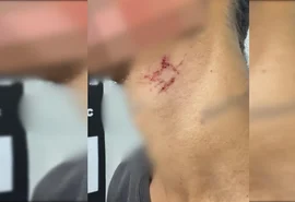 Traficante mantinha jovem como escravo sexual há mais de um ano em Goiânia