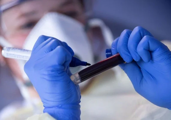 Anvisa divulga informações sobre nova variante da Covid-19