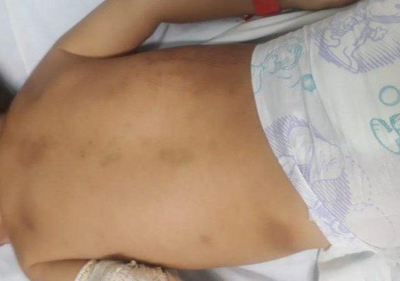 Criança de um ano e dez meses é espancada pela mãe em São José da Laje