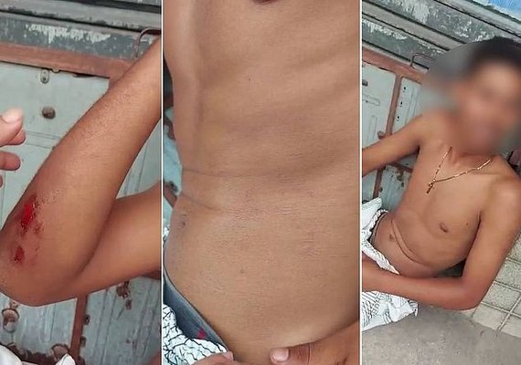 'Negrinho': Agentes da Ronda no Bairro são acusados de agressão e injúria