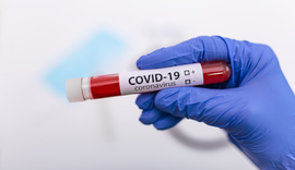 Alagoas confirma 530 novos casos de Covid-19 neste sábado (06)