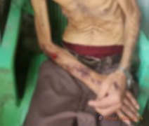 Filho é preso após pai de 80 anos com Parkinson estar em estado de abandono