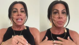Gretchen revela novo procedimento com fios de sustentação no rosto