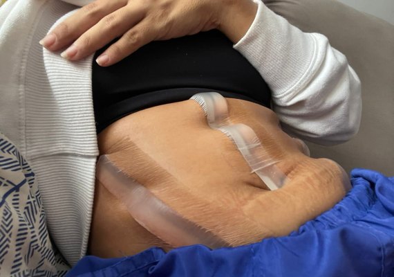 Mulheres que denunciaram cirurgião plástico terão casos analisados por perito