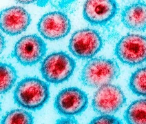 Dois novos casos de possível cura do HIV são revelados em conferência