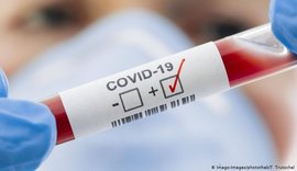 Estado confirma mais 170 casos e 16 óbitos pela covid-19