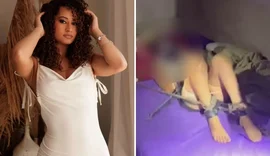 Mulher resgatada de cativeiro relata abusos e queimaduras com ácido na boca