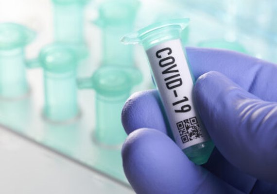 Alagoas confirma mais 729 casos da Covid-19 e 15 óbitos em 24h