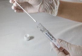 Boletim: Alagoas registra mais 779 casos de covid-19