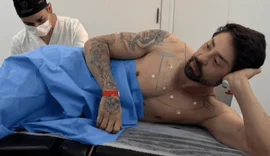 Rico Melquiades revela “cutox” e médico alerta sobre uso da toxina