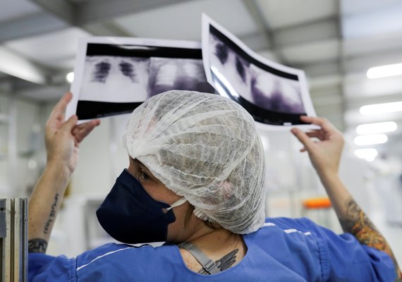 Diagnóstico tardio reduz chances de cura do câncer de pulmão