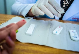 Maravilha retira exigência de teste de HIV em concurso após recomendação do MP