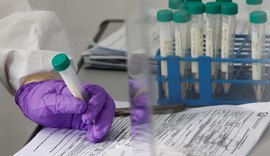 Boletim da Sesau registra mais 349 novos casos de covid-19 em Alagoas