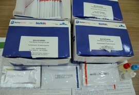Teste Rápido de Zika passa a ser obrigatório para gestantes durante pré-natal em Alagoas