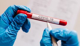 Pandemia dá sinais de controle em Alagoas, segundo Observatório da Ufal