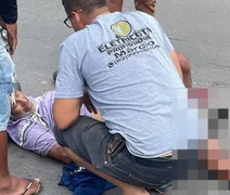 Idoso tem perna esmagada após colisão com ônibus na AL-110 em Arapiraca