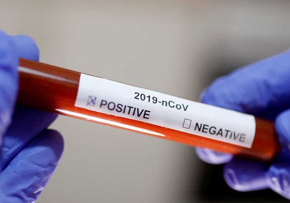 OMS alerta que surto de coronavírus poderá se transformar em pandemia