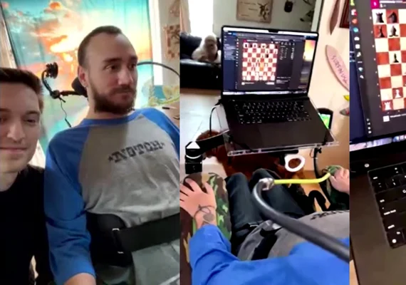 Neuralink mostra 1º paciente com chip cerebral jogando xadrez com a mente