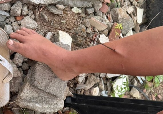 Criança tem perna perfurada por vergalhão em terreno baldio de Arapiraca