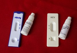 Dia Mundial de Luta contra as Hepatites Virais reforça importância da prevenção e do diagnóstico precoce