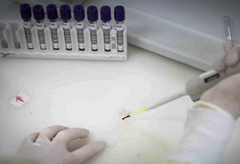 Secretaria de Saúde de SP apura novo caso suspeito de ebola