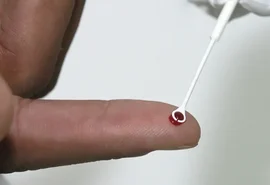 Fiji declara emergência nacional após disparada de casos de HIV