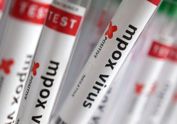 Casos confirmados de Mpox chegam a 140 no Brasil em 2026