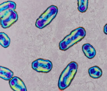 Como a peste bubônica reestruturou o sistema imunológico humano