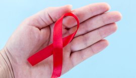 Estado de Alagoas regulariza a oferta de exames aos pacientes com HIV/AIDS