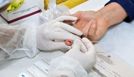 Em 32 anos, Estado de Alagoas registra mais de 6.800 casos diagnosticados de Aids