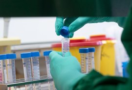 Pernambuco: 774 profissionais de saúde testam positivo para Covid-19