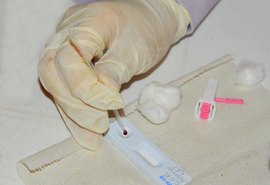 Casos de HIV em Alagoas aumentam 11,89% em 2024