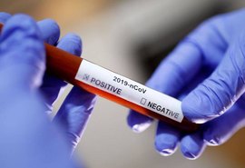 AL tem 47.557 pacientes recuperados da Covid-19