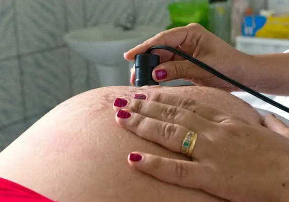 Exame pré-natal reduz chance de bebê nascer com anomalia