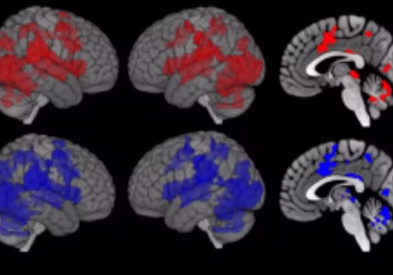Cérebro reage com defesa imunológica só de ver pessoas doentes se aproximando, diz pesquisa