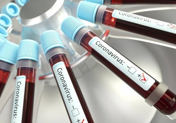 Alagoas registra 993 óbitos de Covid-19 e 33.521 casos confirmados