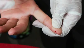 Brasil atinge meta de redução da transmissão vertical de hepatite B