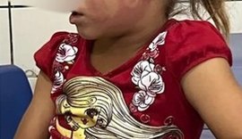 Justiça mantém prisão de homem acusado de agredir a própria filha com chineladas no rosto no interior de AL