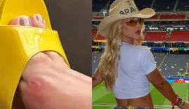 Virginia reclama que saltos fizeram calos em caminhada ao estádio da Copa