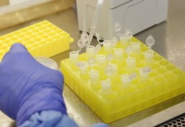 Cientistas identificam proteína que transporta o novo coronavírus