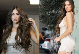 Ex-BBB Deniziane mostra antes e depois de plásticas: “Eu amei”