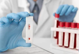 300 casos e 137 mortes: Alagoas atualiza cenário da Aids em 2025